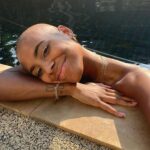 Sharon Battiste Instagram - F R E E D O M 💗 - Der ein oder andere hat mich „oben ohne“ bereits gesehen, nun aber mal ganz offiziell von mir ein Post diesbezüglich. Dieser Schritt war der wohlmöglich schwerste aber auch wichtigste Schritt meines Lebens. Knapp 15 Jahre habe ich täglich mit #alopeciaareata zu kämpfen gehabt und nun ist Schluss! NEW ME! Ich bin so happy damit 💗 Die Rasur war wirklich der Befreiungsschlag meines LEBENS 💫 Ich bekomme von euch täglich sooo viele Nachrichten zu diesem Thema und ich verspreche euch, ich werde euch nach und nach mehr mit in diesen, meinen neuen Alltag nehmen. DANKE, für euren Support 🥺🙏🏾🖤Ich bin SPRACHLOS 🖤 - #team #glatze #alopeciaareata #newme #happy #sharonbattiste 📸 FOTO RTL / René Lohse