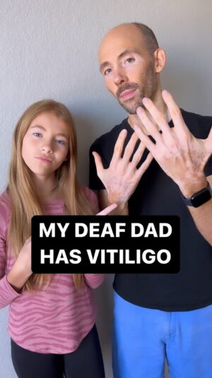 Shaylee Mansfield Instagram - Real talk… my Deaf dad has vitiligo and we had a chat about his journey. Vitiligo or not. Deaf or not. Or whatever it is. It’s time to embrace people of all kinds. 💜✨