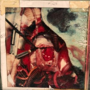Skeet Ulrich Instagram - A rare look inside my heart 😳 39 years ago today I had a 25% chance of surviving open heart surgery. Thanks to the skill and dedication of my surgeons I am alive and well. Thank you to everyone who have dedicated their lives to saving others. 🙏❤️