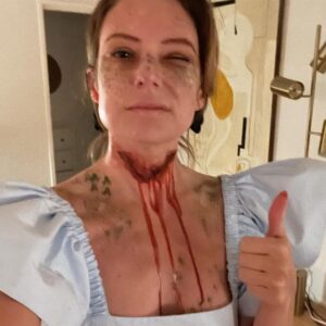 Sugar Lyn Beard Instagram - WARNING: Fake neck wound* Few people remember the original Peter Pan story in which Wendy slits her own throat to escape the bad lost boys, only to come to life again and be surrounded by gay cowboys where she finds true happiness. Don’t look it up, just trust me it’s true. *for the record I do not believe in slitting throats, under any circumstances.