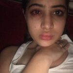 Urfi Javed Instagram - Just clarifying to these pictures are from 2016-2017 , not current Sharing with you all my lip filler journey I’ve been getting lip fillers from the age of 18 , I didn’t have that much money back then but I always felt my lips were too thin and I wanted bigger fuller lips . I went to dermat deni we’re ready to do it for less and these were the results at times ! I had to get them dissolved and mind it it’s the most painful thing ever !! I’m not telling people to not get them but Infact what I’m trying to say is just be careful while getting fillers or Botox . I still very much have lip fillers just that I know what suits my face and I know now less is more . Encouraging everyone to throughly research before going to any doctor . I actually revvokend fillers to everyone , if you have some insecurities about your face or body instead of hating yourself or your face it’s just better to opt for fillers or surgeries but but but from a very good doctor only.