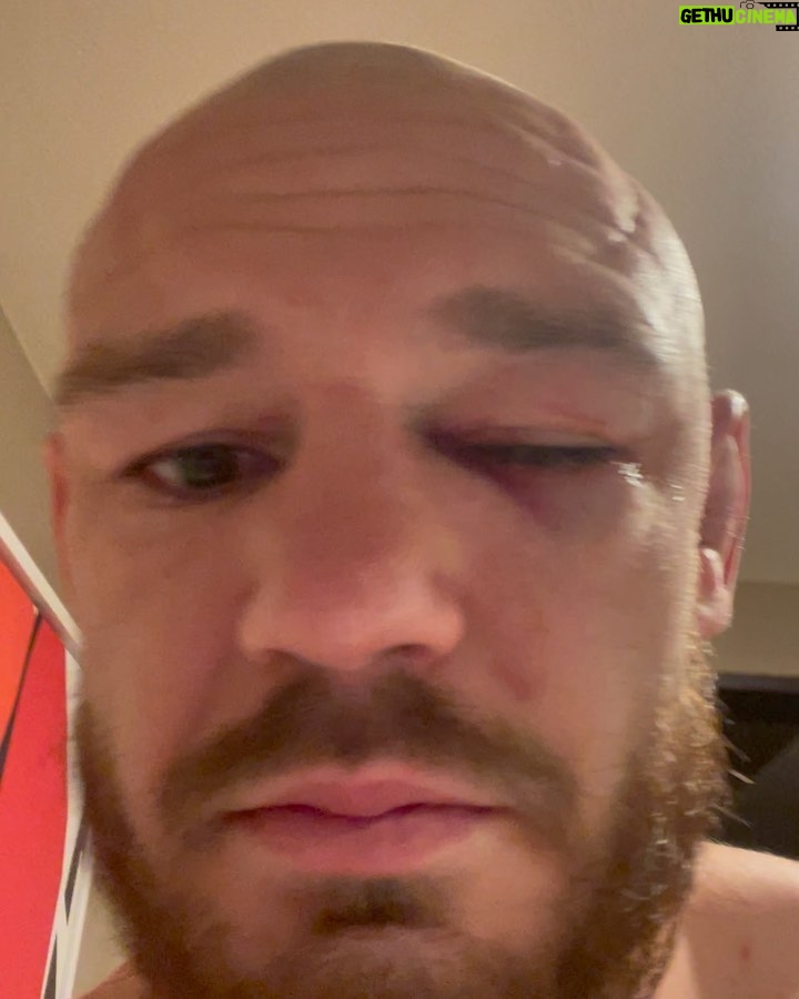 Viacheslav Borshchev Instagram - Because of eye poke I went to the hospital and have missed post fight interview, and I did not have the opportunity to thank all those involved, or at least the most involved. My wife @borshcheva__m , i don’t remember if I ever had such a strong support from you and now I know, together, we can reach any goals we want. My team @teamalphamalemma ( @kickboxingvlg )main couches @urijahfaber , @joey_rodriguez916 , @lastcall155 , @mvmnt_darren . extra thank to @urijahfaber for opening so many doors for me. Thank you @seaneaddy for giving me a hand in such a tough life moment. Thank @ufcpi for helping me prepare so well, probably better then ever. @the_massage_messiah @getmegoings your massage was big part my last camp thank you I felt amazing during the fight Thank Violetta Mordukhay the best lawyer in the game, she gave me big relief in right time. And of course thank @ufc , @seanshelby and @danawhite personally for giving me opportunity to show my skills and let people enjoy pure violence. #viacheslav_borshchev #slava_claus #teamalphamale #sacramento #volgograd #mma #ufc #fight UFC APEX