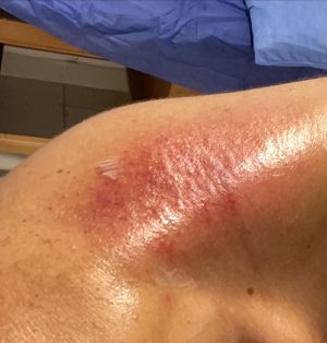 Ahmed Salah ElSaadany Instagram - اول ما ابتديت اسخن و ارجع للچيم كتفي و رقبتي قعدوني في البيت بروح اعمل جلسات علاج طبيعي و اول ما اخف ان شاء الله ححاول انزل تاني اتمرن لان الرياضه بتفرق كتير في النفسيه هي دي باختصار الحياه 
Ups and downs 🤷🏻‍♂️