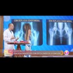 Alexandre Rossi Instagram - Você já ouviu falar em displasia coxofemoral? É uma doença comum em cães, e que afeta a articulação da bacia com o fêmur. Ela pode causar dor, dificuldade de locomoção e até dificuldade pra levantar e deitar. E por isso, hoje no programa Encontro com @patriciapoeta, falei um pouco sobre o que você pode fazer para garantir o bem-estar do seu cão com displasia. Vem conferir e já me conta se já sabia disso! : #alexandrerossi #drpet #displasiacoxofemoral #cachorrocomdisplasia #cachorro #saudeanimal #programaencontro #tvglobo