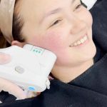 Angelica Panganiban Instagram – The new mom, @iamangelicap is back at @theaiveeclinic with her must-have Aivee treatments to maintain her youthful glow!

With the help of Aivee Ulthera Maxx Lift, she will now say goodbye to saggy and dull skin she has experienced after her pregnancy.

AIVEE ULTHERA MAXX LIFT
✅ The gold standard in non-invasive skin tightening and lifting treatment.
✅ Boosts collagen production and skin elasticity
✅ Noticeable results!

Try this treatment
by book an appointment now.

+63917 728 3838
+63969 223 0517
+63969 223 0499

#theaiveeclinic #aiveeclinic #draivee #drzteo #angelicapanganiban #aiveeultheramaxxlift