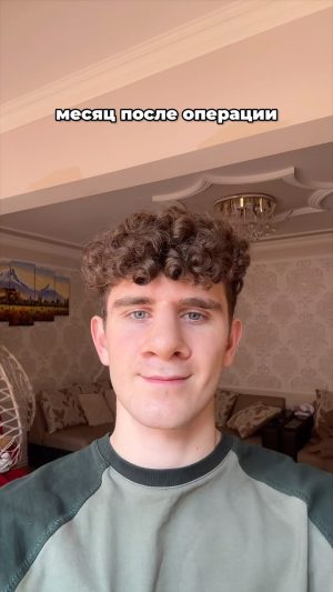 Artur Babich Instagram - как вам мой новый нос?😌