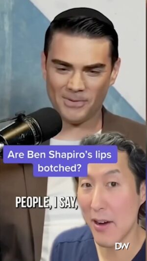 Ben Shapiro Instagram - Apparently people think I use lip filler. Um…no.