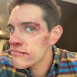 Casey Cott Instagram - The day we shot this I FaceTimed my mom and told her I had fallen down a flight of stairs and she totally bought it.