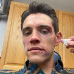 Casey Cott Instagram - The day we shot this I FaceTimed my mom and told her I had fallen down a flight of stairs and she totally bought it.