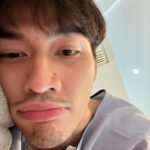 Chinnarat Siriphongchawalit Instagram - จะหายได้ยัง