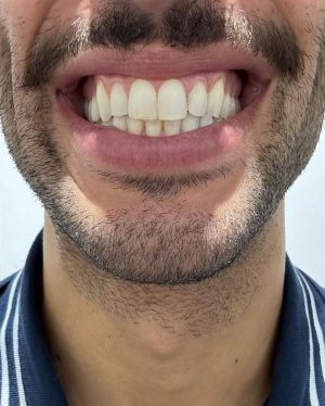 Daniel Ricciardo Instagram - I’m keeping the mo! P4 👨🏻