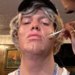 Dillon Francis Instagram - It all started one day when someone said I didn’t look pretty so I got plastic surgery for a single day to prove them wrong (some would call that crazy, I call it dedicated) Also took a picture with all my exes, swipe to the end to see what they look like now