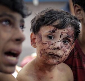 Essam Elsakka Instagram - 🇮🇱 Hi @Israel when will you STOP BOMBING CHILDREN IN GAZA? #gazaunderattack  #gazapalestine  #savegaza  #israel  #israelturismo #israelterrorist #israeltravel