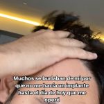 Gabriel Montiel Instagram - Por fin me hice el implante