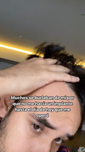 Gabriel Montiel Instagram - Por fin me hice el implante