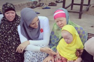 Gamze Özçelik Instagram - Bazı hayatları gördükçe, Allah’ın bana nasip ettikleri karşısında nasıl şükredeceğimi şaşırıyorum. Verdiklerinin karşısında layık olabilecek miyim bilmiyorum. Gücüm ne kadarına yetecek bilmiyorum.  Bildiğim bir şey varsa, o da açtığı bu yola aşkla sarıldığımdır. ‘O’nun ipine sımsıkı sarılmaktan başka neyimiz var ki?.. ❤️ @umudakosanlar #UmudaKosanlar #Albino #Africa #Tanzania #Love #Ramazan2019