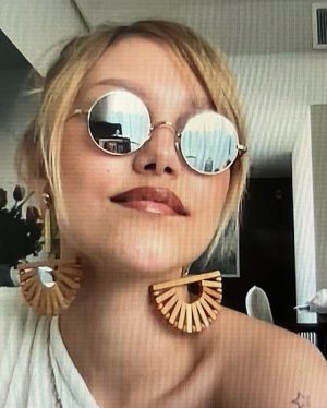 Grace VanderWaal Instagram - I have a pimple on my cheek that’s making my life a living hell- remedies would be v appreciated