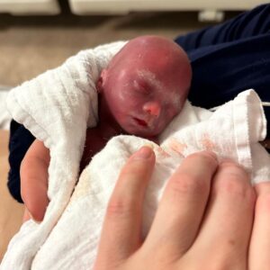Hafþór Júlíus Björnsson Instagram - T.W stillbirth/delayed miscarriage.  It is with great sorrow that we announce the birth of our daughter, Grace Morgan Hafthorsdottir born Nov 8th at 21 1/2 weeks gestation.  After a noticeable decrease in movement we found out her heart had stopped beating.  Words cannot describe our pain of this loss or our happiness at being able to spend time with our daughter. She is absolutely beautiful, with blonde lashes and brows and a little smile for mom and dad. The love we feel for her is overwhelming.  The grief we feel will be with us forever but so will the love.  All of our hopes and dreams for her have been taken away from us but I know I will be with her again.  Her spirit lives on through us and her siblings.  We ask that you respect our privacy at this time as we grieve this unbearable loss. Thank you all for any kind words and support.