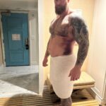 Hafþór Júlíus Björnsson Instagram - I know this looks bad, but I actually feel terrific. I am confident that the team around me will produce an optimal outcome for me. It may sound strange, but I actually can’t wait for the surgery tomorrow. PS I’m posting a new YouTube video of my recovery journey, at 9am PDT or 4pm GMT tomorrow