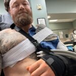 Hafþór Júlíus Björnsson Instagram - WARNING GRAPHIC SURGERY FOOTAGE. Live on my YouTube channel. Wednesday I’m 4 weeks post surgery. Sadly I got an infection 5 days ago resulting in an abscess and had to have a drainage tube inserted. Finally had that removed today. Swipe to see the length of it! 🤯