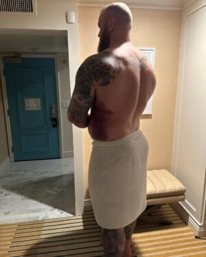 Hafþór Júlíus Björnsson Instagram - I know this looks bad, but I actually feel terrific. I am confident that the team around me will produce an optimal outcome for me. It may sound strange, but I actually can’t wait for the surgery tomorrow. 
PS I’m posting a new YouTube video of my recovery journey, at 9am PDT or 4pm GMT tomorrow