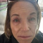 Katie Couric Instagram - Calling all sensitive skin sufferers! 🙋‍♀️ I’ve had eczema ever since I was a little girl, and as I've gotten older, it's started to flare up again. I also deal with allergic contact dermatitis — safe to say, I have to be careful about what I put on my face. My search for treatment led me to @cherylleemdisme. Her products have really helped. I asked Lee a lot of questions about what causes eczema and how to calm flare-ups. You can find all of her tips and tricks at the link in my bio. 🙌 (I can’t believe I let my team post this picture. Good Lord 🥴) #sensitiveskin #skincare #skincareroutine #dermatologist #eczema