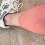 Macklemore Instagram - At least I got built in socks for the next year 🤷🏼‍♂️🫠… Can anyone relate? #neverwearingshortsagain
