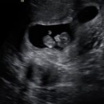 NF Instagram – Bringing a human into this world.
I’m going to be a dad.
The end.
