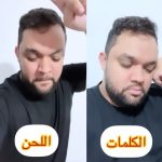 Oussama Ramzi Instagram - الكلمات كاعيين و اللحن ما قاداه فرحة 😂