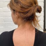Princess Eugenie Instagram - Today is International Scoliosis Awareness Day. I just wanted to share my scar and encourage anyone out there who's gone through something similar to share theirs with me. Let's be proud of our scars! I'd love to repost any of your images on my stories so please tag me and I will share. #internationalscoliosisawarenessday