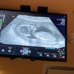 Sabrina Seara Instagram - Tenemos noticias 🤭🤭🤭🤭 Esta familia no puede estar más feliz , Maxi será ascendido a hermano mayor en Julio . Gracias a todo el equipo @hola_mx y a nuestros cómplices que hicieron posible esta sorpresa! Más de 4 meses de amor ❤️ #noseaslocachica #prontoseremos4 #holamexico #pregnancyannouncement #pregnancyphotoshoot