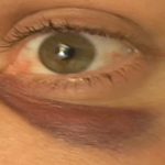 Steve-O Instagram - The Black Eye Game… Happy Birthday to Jeff Tremaine (aka @gorillaflicks)!