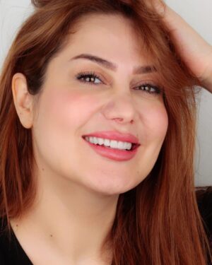 Zuhur Alaa Instagram - صباحكم خير وبركه 
حبيت الصوره لافلتر ولاشي تره صدك الفلاتر غيرت اشكالنا المهم 
شكرا لعيادة ڤينوس♥️ الي كانت ومازالت مستمره طلعني بااحلى صوره 
وشكرا دكتوره زينب مؤيد♥️ الي رجعت ابتسامتي الحلوه ابتسامه المشاهيرر ♥️
مركز ڤينوس
@venusclinic1
دكتوره زينب 
@dr.zainebmuayad