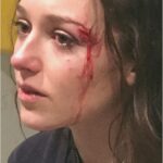 Katie Douglas Instagram - :) I wrote you a song called “20 years and only 4 scars on your face”. Or just “sister”. Idk yet. See ya when I see ya