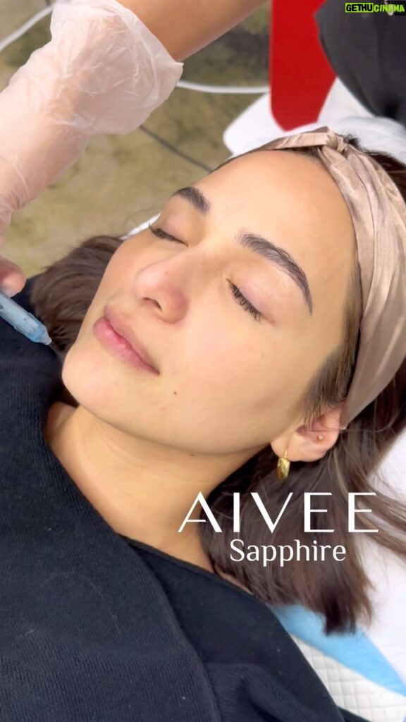 Jennylyn Mercado Instagram - Introducing the latest skin treatment intended for extraordinary glowing skin: the AIVEE SAPPHIRE!✨

FIRST AND EXCLUSIVE at #TheAiveeClinic, the AIVEE SAPPHIRE is the most advanced and versatile skin therapy system in the market because of the combined power of hydropolation and radiofrequency, giving a wide range of non-invasive and skin-relaxing procedures intended for deep moisturization, skin toning, and skin rejuvenation.

It is best for:
✅ anti-aging
✅ skin toning
✅ skin glow and rejuvenation
✅ deep moisturization
✅ increases skin permeability with long lasting result

AIVEE SAPPHIRE also targets the LYMPHATIC DRAINAGE through exfoliation to needle-free sub-dermal therapy leaving an extremely pleasant and refreshing skin toning procedure for an immediate glowing skin.

Checkout @mercadojenny at @theaiveeclinic VERTIS BRANCH doing the latest treatment, the AIVEE SAPPHIRE!

AIVEE SAPPHIRE is available in all clinic branches! Send us a message book an appointment with us now!
 63917 728 3838
 63969 223 0517
 63969 223 0499

#theaiveeclinic #aiveeclinic #jennylynmercado #mercadojenny #aiveesapphire #draivee #drzteo #aiveetreatments #aiveeleague #aiveelove #antianging #skinrejuvenation #skinhydration #skintoning