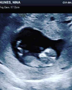 Amanda Nunes Instagram - We can’t wait to see your little face, Hazel Ann Nunes. 👩‍👩‍👧‍👧