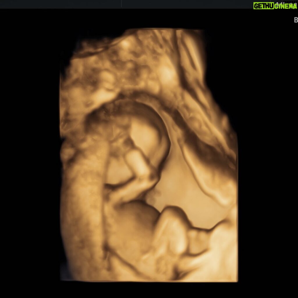 Capucine Anav Instagram - A ce moment précis j’étais enceinte de 5 mois et j’étais à j-2 de vous l’annoncer 😍😍 … Ma grossesse était incroyable et j’étais frustrée de devoir vous le cacher pendant 5 mois, mais j’étais obligée pour protéger ma grossesse ! A l’époque j’avais mis cette photo en story en coupant mon ventre … maintenant je la poste entièrement 😍😍😍🫶🏼🫶🏼🫶🏼
