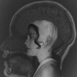 Chanya McClory Instagram - Me and my first MRI film when I discovered the brainstem tumor. Four years ago today was the day I first discovered it. After one surgery, it got smaller, but it continue to grow with me every day. However, as long as it hasn’t decided to let me go, I will keep going on my path! Shoutout to all the strong women followers on this #internationalwomensday Don’t let anything stop you from pursuing your dreams :) Thank you to everyone who was a part of this personal shoot. Miss you all! @thenapat_photographer @brizzlechizzle @sup.sneak @_kilbill
