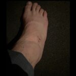 Chris Pratt Instagram - Mercy filming day 4. I have such a great stunt team! AND I sometimes try to get in there and do some of my own stuff. Today, daddy caught a metal post to the ankle. Should be interesting moving forward. 🧐