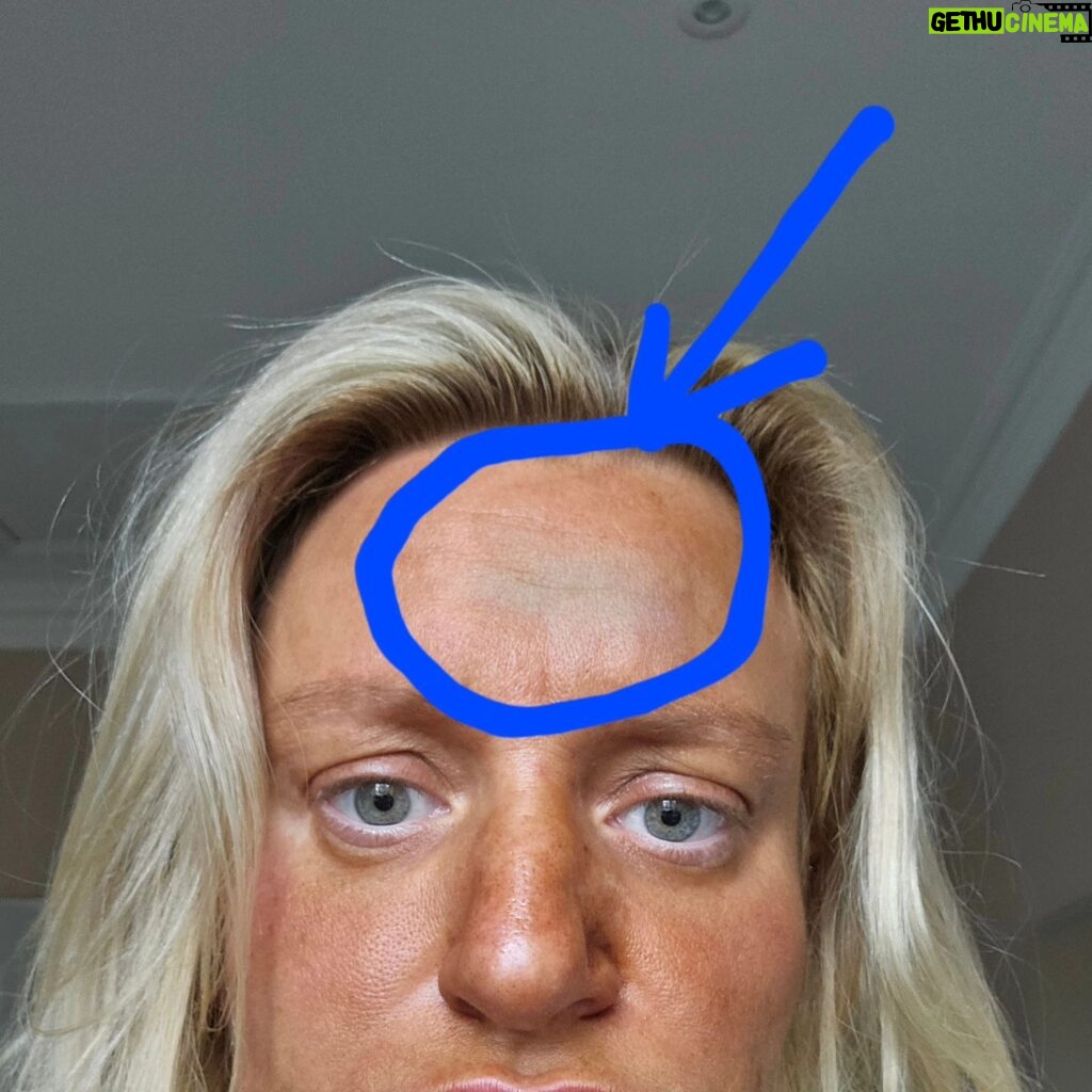 Daisy May Cooper Instagram - Crushed up a dishwasher tablet into a paste and scrubbed forehead now its going green. Is that from dishwasher tab or tan developing????