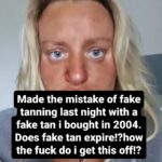 Daisy May Cooper Instagram – Please help. The fake tan i used is 20 years old? No fake tan remover is working and lemon juice is not working. Tried nail varnish remover and that just burns
