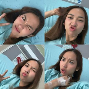 Danupha Khanatheerakul Instagram - สวัสดีค้าบ ส่งท้ายปีเก่าด้วยการ เป็นซีสต์ที่เส้นเสียง เย้ อ่าว ไม่ใช่ แฮะๆ 

หลังจากที่ใช้เสียงอยากต่อเนื่องไม่พักผ่อนนั้น มินก็เกิดอาหารคอแดงคอบวม (ซึ่งเป็นปกตินะฮะ เราพักผ่อนน้อยเองด้วย) เลยตัดสินใจไปตรวจที่โรงพยาบาลเฉพาะทาง และพบว่าตัวเป็น ซีสต์ที่เส้นเสียงข้างซ้ายข้างเดียว คือจะตัดออกก็ได้หรือจะปล่อยไว้ให้มันแตกเอง แต่มันก็อาจจะไม่แตกเองก็ได้ nobody knows คับ ถ้าผ่า โทนเสียงก็อาจจะเปลี่ยน แต่จริงๆคุณหมอบอกว่าไอ้ซีสต์นี้นวยก็น่าจะมีมาได้สักพักใหญ่ๆแล้วเนื่องจากโทนเสียงของนวยเปลี่ยนไปแล้วรอบนึง คือทุ้มต่ำลง ใช้เวลาตัดสินใจไป1สัปดาห์ ว่าจะผ่าตัดเอามันออก คือขึ้นชื่อว่าซีสต์ ตรงที่เส้นเสียงมันไม่ใช่ที่ที่มันควรอยู่อยู่แล้วอ่ะเนอะ

ความจึ้งเกินอยู่ที่ว่า ก่อนหมอจะรมยาสลบ หนูสลบก่อนแล้ว กูหลับเบิ๊ดด หมอต้องปลุกมาดมยาสลบ55555 เลิศต่อมาคือ พอหมอสอดกล้องจะผ่าเอาอีก้อนออก ปรากฎว่า มัน already แตก แบบห๊ะ แบบร่างกายมัน heal ตัวเองไปแล้ว ซึ่งเป็นเรื่องดีนะคะ55555 เท่ากับว่าเราจะหายไวขึ้น ใช้เวลาพักฟื้นน้อยลง คุณหมอว่า โอกาสที่ซีสต์จะเองนี่ไม่ง่ายเลย แต่ก็ดีแล้วค่ะ 

หลังจากนั้นคือห้ามพูด สามวัน แต่ว่าอยากเล่าเรื่องราวให้พี่ๆฟังเลยส่งไปแบบคลิปสุดท้าย 5555555 

สุดท้ายนี้ใครๆก็เป็นซีสต์ได้ รักษาเนื้อรักษาตัวไว้ด้วยนะคะทุกท่าน ปีนี้คงไม่ได้เจอกันในคอนแล้ว แต่อาจจะได้เจอมิลลิตามวัดหรือสถานที่สนุกๆนะคะ อิอิ เบิ้บบูทุกคนมากๆ ปีหน้าเจอกันใหม่ เสียงใสอย่างกับนกไนติงเกลค่ะ เสมอมาเสมอไป 🫶🏽✨