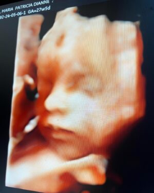 Diane Medina Instagram - 3D/4D of our Baby Girl at @babybondultrasound.ph 💖 Thank you so much @babybondultrasound.ph for accommodating us! Super happy nagpakita agad si Baby! Heheh Love you anak 🌸

To all the Preggy Mommas, you can have your Ultrasound Check up, Congenital Anomaly Scan, 3D/4D Live Ultrasound with Printed Scans and Frame just message @babybondultrasound.ph located at 3rd level of SM The Block 🌸