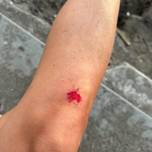 Emmanuelle Cureau Instagram - BALI DUMP 🐚 
1- Moi et ma pote en snorkeling : Nice Day
2- Nouvelle conductrice 🛵 
3 - Mes trésors 
4 - Activité journalière 
5 - Nuits difficiles 🤍 
6 -  Bali Vibes    
7 - Les émotions : LA solution 
8 - Mon bobo en forme de cœur 🥹 
9 - Happy Girl 🐚
10 - Feel Like Home