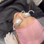 Faezah Elai Instagram - Salam ampa maini nk share ngan ampa.. maini try buat treatment muka kt @clinicrxmy bangi Q-Switched Laser as it is one of the most effective laser treatments currently available, and provides different wavelength, suited to different skin conditions. Q-Switched can be treated for: -Melasma -Skin rejuvenation -Skin Whitening/ Brightening -Post-Inflammatory Hyperpigmentation . First ampa buat treatment ni.. kulit maini lembut elok ampa.. mcm budak lepaih spm.. 🫣 Ampa Klu ada duit lebih pi try lekaih treatment.. sebut nama maini insyallah dpt discount!! 😆 . #rxclinic #treatment #facetreatment #faezahelai