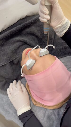 Faezah Elai Instagram - Salam ampa maini nk share ngan ampa.. maini try buat treatment muka  kt @clinicrxmy bangi
Q-Switched Laser as it is one of the most effective laser treatments currently available, and provides different wavelength, suited to different skin conditions.

Q-Switched can be treated for:

-Melasma
-Skin rejuvenation
-Skin Whitening/ Brightening
-Post-Inflammatory Hyperpigmentation
.
First ampa buat treatment ni.. kulit maini lembut elok ampa.. mcm budak lepaih spm.. 🫣
Ampa Klu ada duit lebih pi try lekaih treatment.. sebut nama maini insyallah dpt discount!! 😆
.
#rxclinic #treatment #facetreatment #faezahelai
