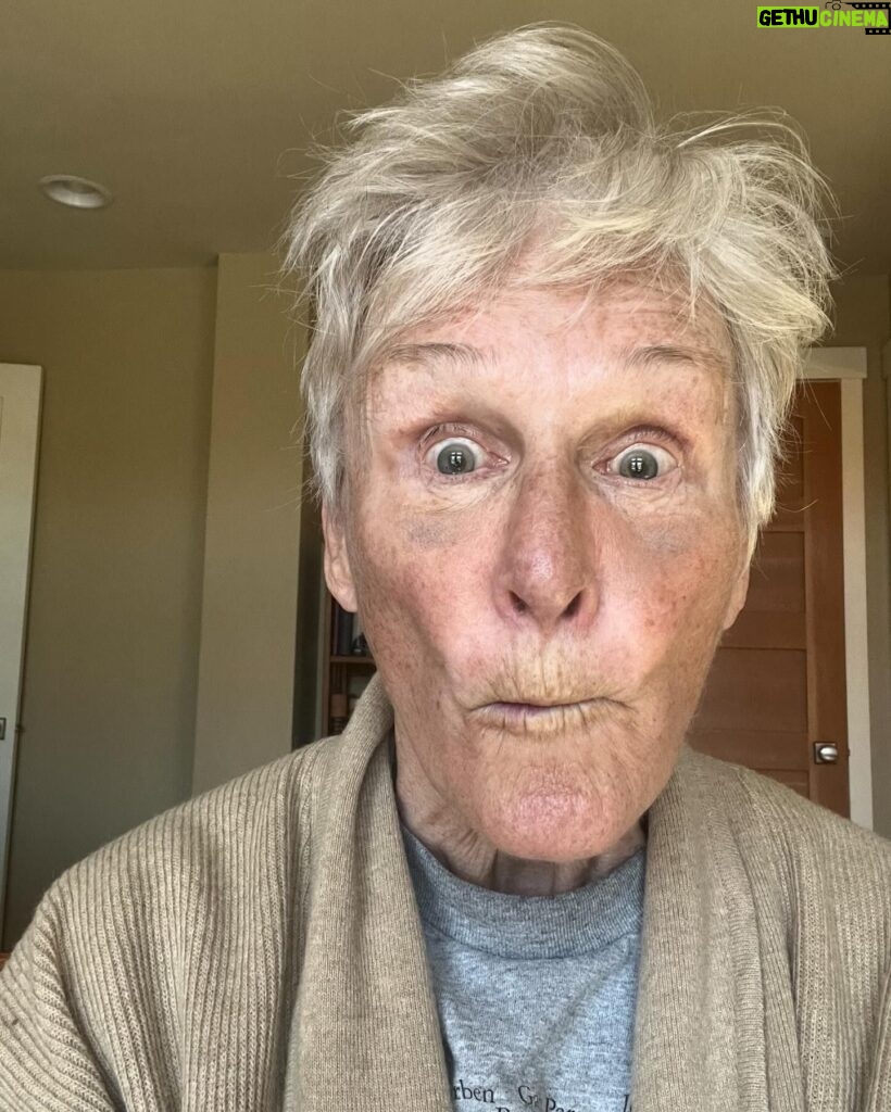 Glenn Close Instagram - I think this is going to be a particularly GOOD day. (Ignore the bruises. I had a tiny break in my nose fixed) Feeling as beautiful as ever.