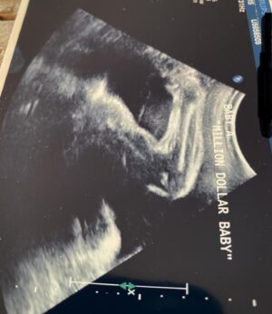 Hilary Swank Instagram - Baby A flexing for the camera at their ultrasound. 💪🏽🤣
#TheRealMillionDollarBaby #Prizefighter
