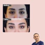 Huda Husain Instagram - دكتور محمد حمود وعملية جفوني القادمه بتكون معاه في عيادة بيوتي كلينك @beautyclinick