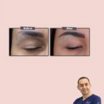Huda Husain Instagram - دكتور محمد حمود وعملية جفوني القادمه بتكون معاه في عيادة بيوتي كلينك @beautyclinick